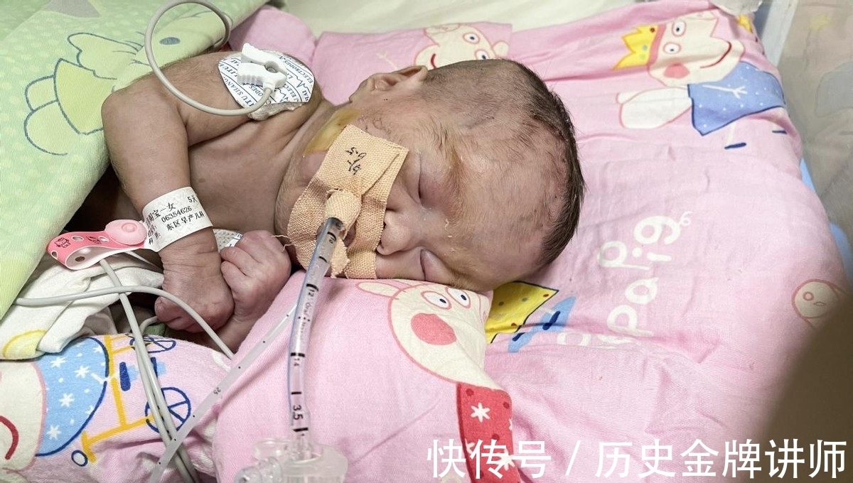 孩子|河南90后女子怀上三胞胎全家人高兴不已，孩子出生后却笑不出来了