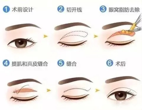 眼周状态出卖了你的年龄!