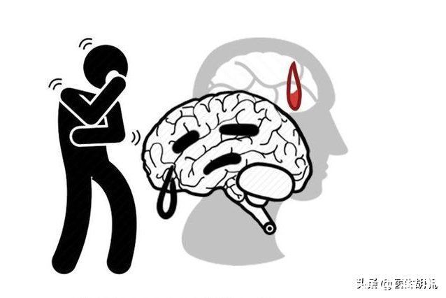 四肢|头疼和血管杜塞有关系吗？不瞒你说，8种情况暗示你血管病