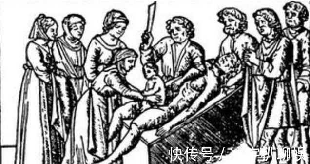 陆终|古代有剖腹产吗 原来最早的剖腹产不是为孕妇准备的!