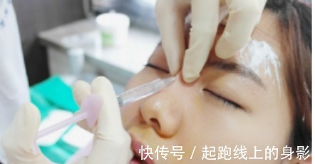 风险 鼻炎能做隆鼻手术吗隆鼻之后会有哪些术后风险!