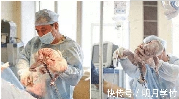 手术|产妇刚生完宝宝,忽然一句“想上厕所”,医生大喊:准备手术