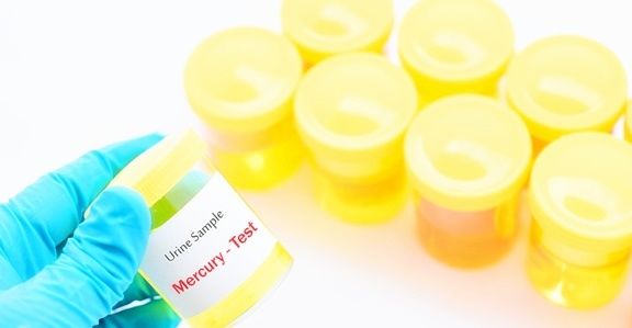 血糖|糖尿病患者的尿又黄又骚是什么原因?你真的知道吗?看专家的理解