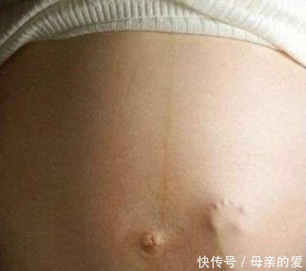 孕28周胎动一直不明显 孕28周胎动一直不明显