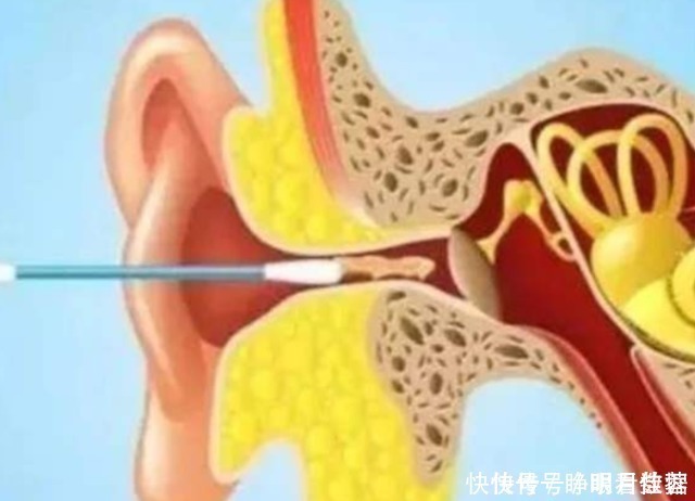 棉签|用棉签掏耳朵到底有多危险?3D动画演示,原理一目了然
