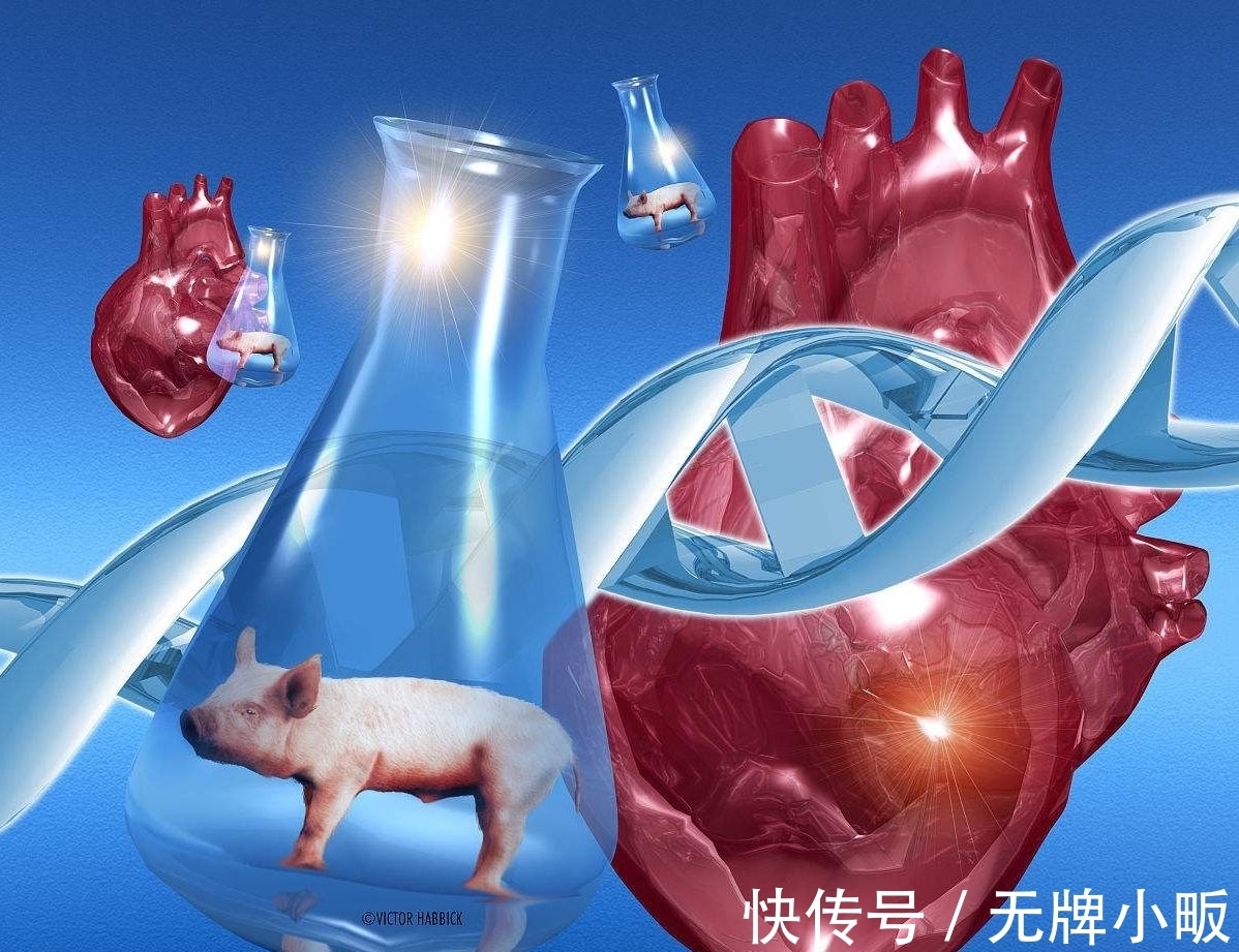 移植|狒狒心脏可以代替人类心脏吗?加州这个女孩,移植心脏后活了21天