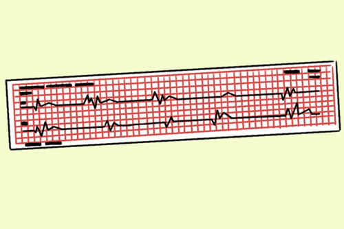 心脏不舒服，但彩超和心电图都无异常，原因在哪里？