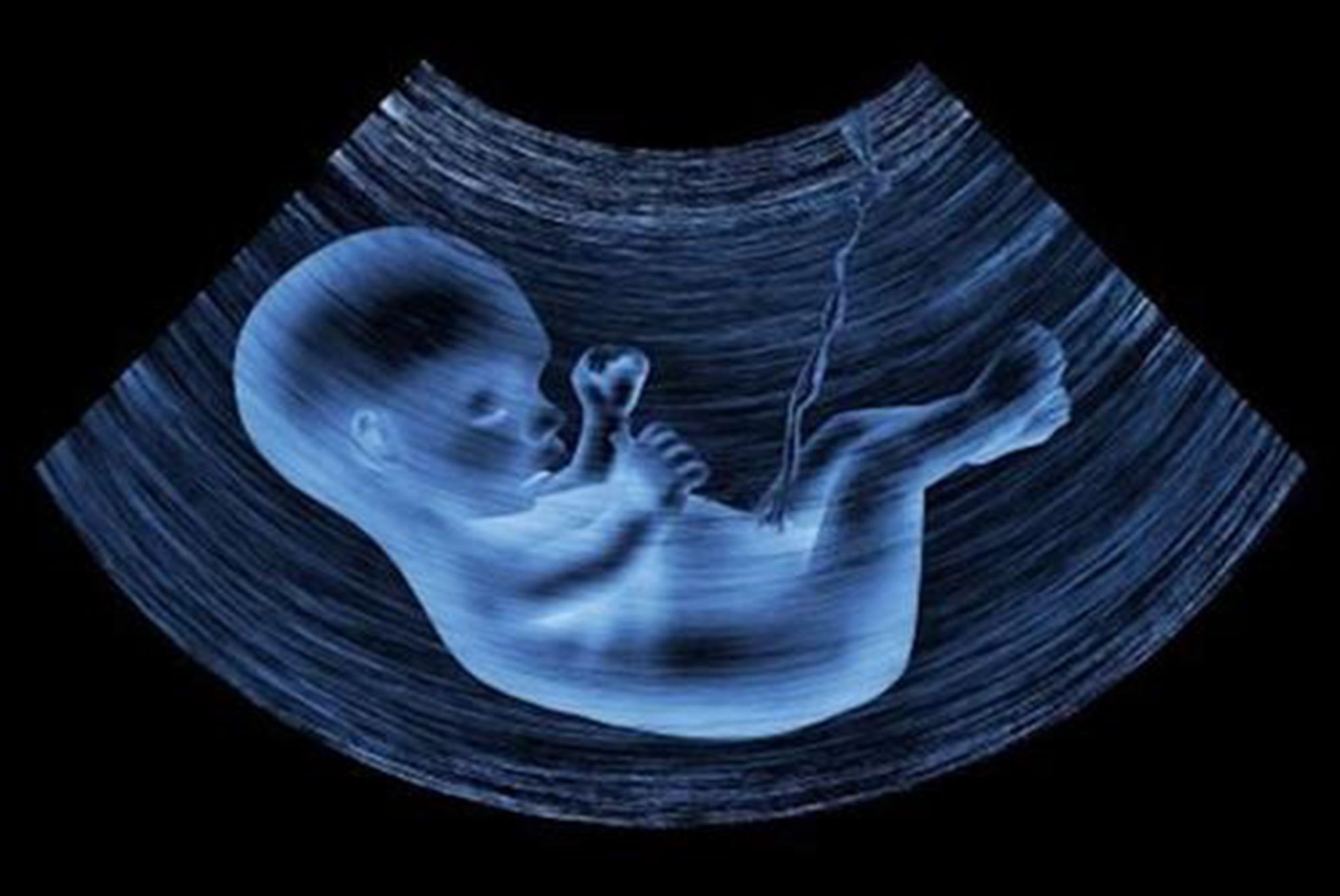 怀孕22周胎儿位置图片图片