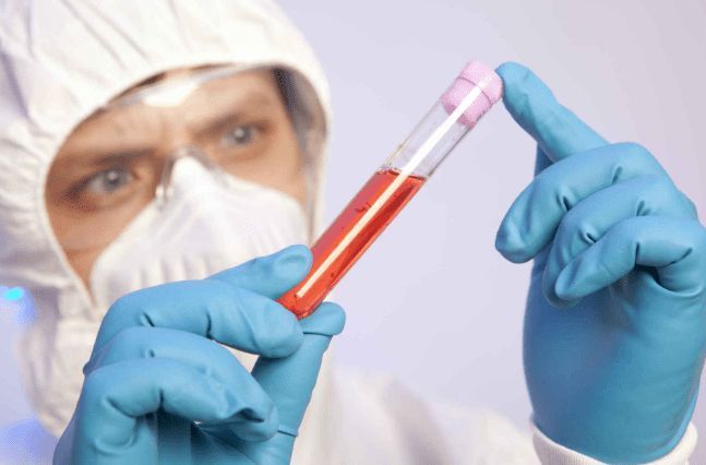 肥肉|高血脂的“发物”已列出，第一名并非肥肉，这3物不少人喜欢吃