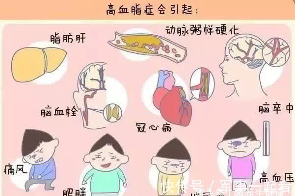 血脂|血脂高的人,身体会有4个表现,建议少做3件事,或可有助调节血脂