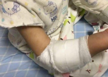 爷爷奶奶|4岁女孩总喊手臂疼,送到医院检查后,医生再晚就来不及了