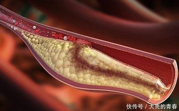 枸杞|黄芪和“一物”天作之合,坚持每天喝,养肝排毒,血栓可能绕远路