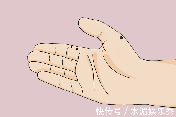 发红|肝硬化先上手脚,手脚的哪些变化,暗示了肝硬化可能找上门了?