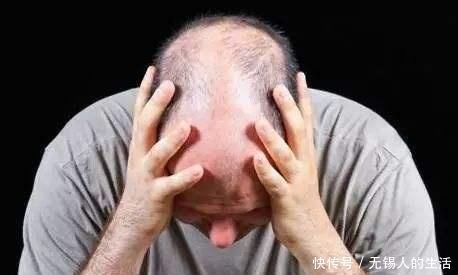 出现这5个现象,有可能会脱发每天5分钟,让毛囊恢复掉发回来