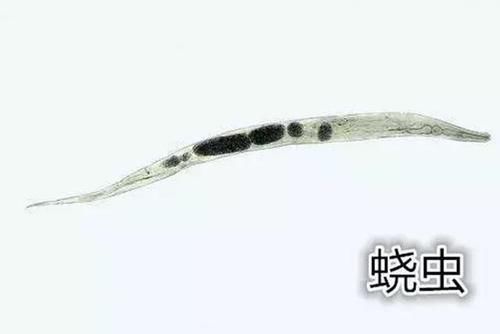 3岁宝宝晚上哭闹说“屁屁痒”,妈妈脱下裤子一看,有东西在动