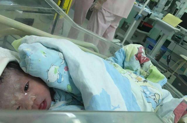 乳白色|新生儿全身涂满“猪油”,母子相见吓坏产妇医生这是好事