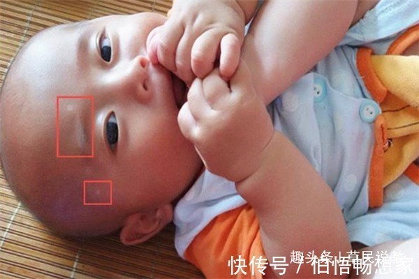 蛔虫|当孩子有这些情况时,便意示着肚子里有蛔虫了,父母们要留意了