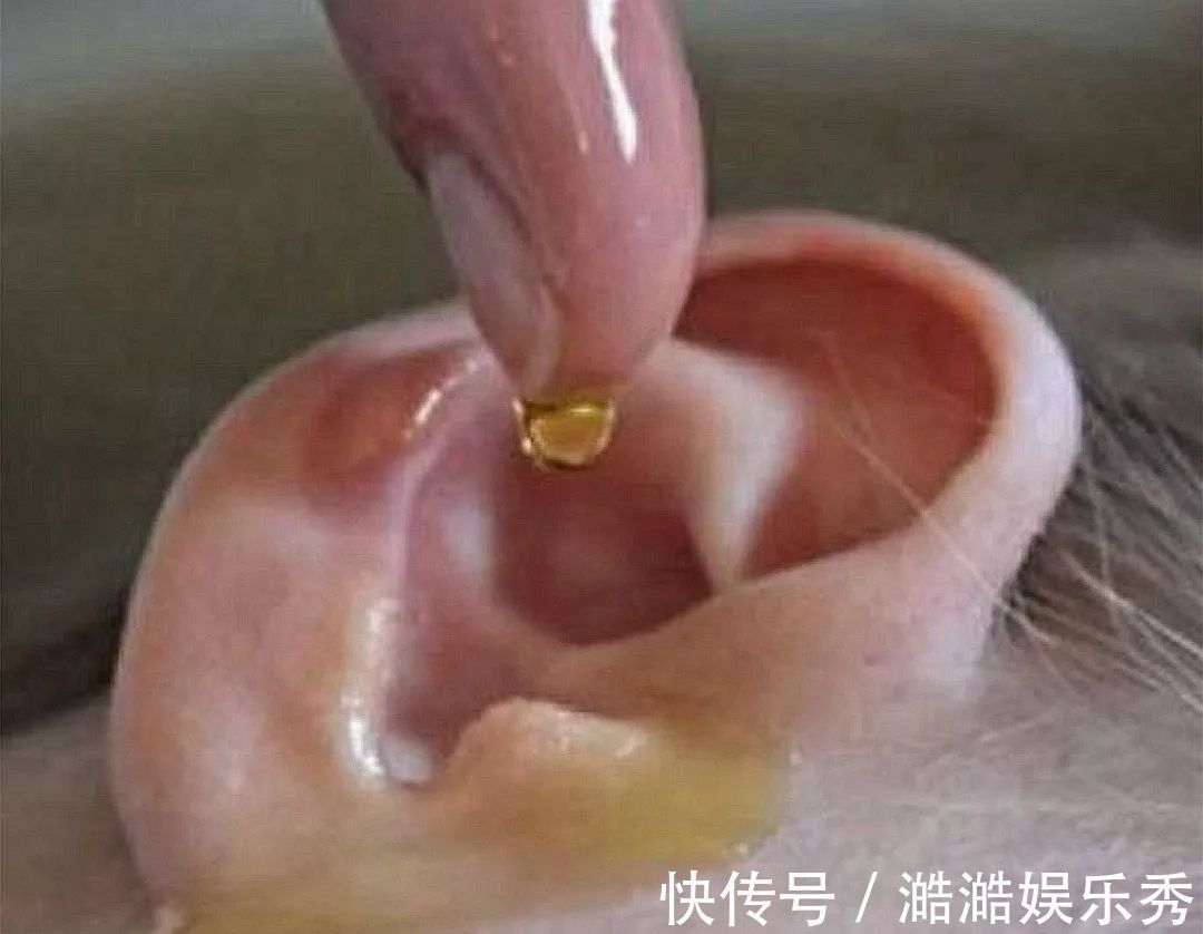 听力|娃耳朵进虫子,妈妈果断地处理方式救了孩子的听力,连医生都夸赞