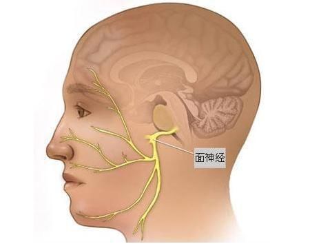 面部|潍坊市人民医院专家提醒：不是所有的面部抽动都叫面肌痉挛
