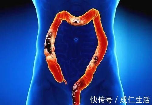 肠道|消化科医生：便秘万万不可拖，日常坚持5个方法，越来越通顺