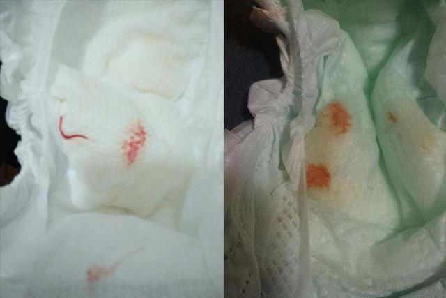 甜菜红素|“妹妹流血啦,妈妈快来”,面对意外,哥哥的反应让医生竖起拇指