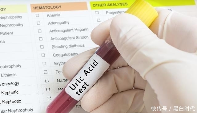 早好|高血压,长期服用“降压药”,身体或许会有5个变化,早知道早好