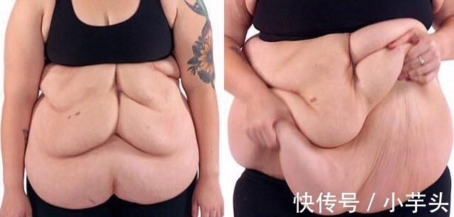 体重|体重580斤的胖妞，成功减肥260斤，松弛的赘肉让她后悔不已！
