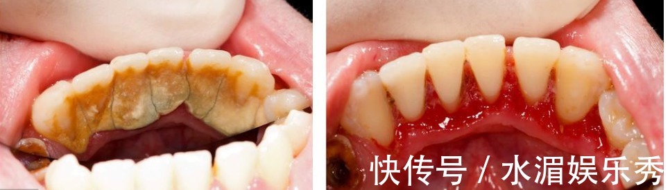 信号|大病来临前的10个信号,需要时刻注意,健康常识!