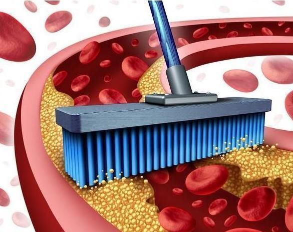 维生素c|高血脂多是“吃”出来的医生警告3种食物不戒掉，血脂不会降