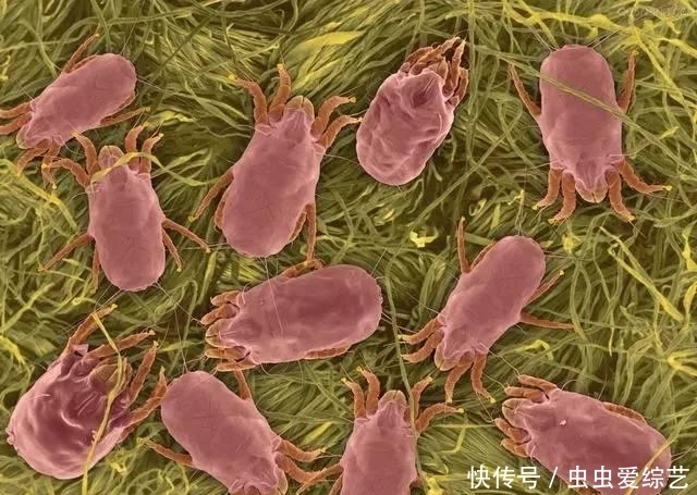 天呐!螨虫居然能在头上搞出那么多事,你是不是也中招了?