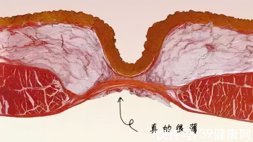 细菌|老人常说肚脐的“泥”不能抠，靠谱吗？放大1000倍，找到答案了