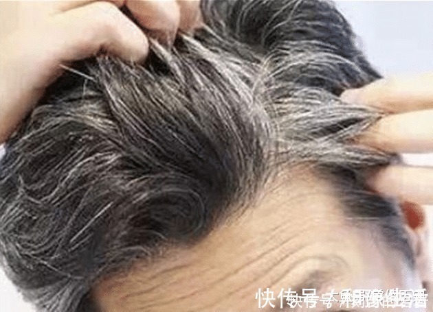 黑色素|为什么白发多的人不容易得癌症科学家给出原因,听完傻眼了