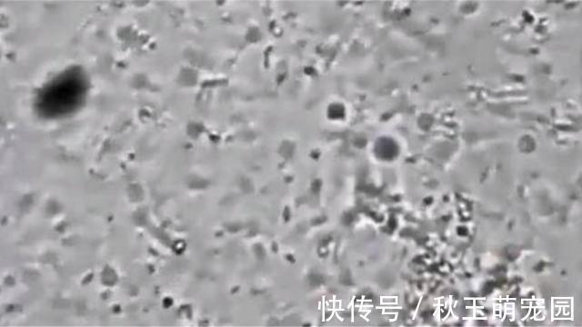 肚子疼!肚脐眼里的“泥”到底是啥?能不能抠?显微镜放大1000倍,真酸爽