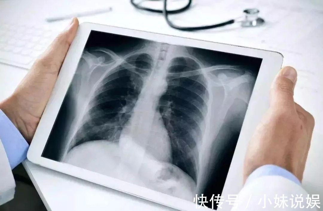 张中海|同时患上两种癌症,他是如何“起死回生”的?