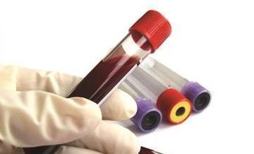 血脂|长了颈动脉斑块,以前吃肉多血脂也高,改成吃素能消除斑块吗?