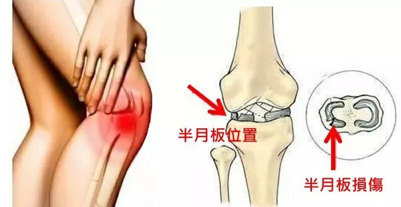 韩毅雄|每天练 1 次,延长膝盖寿命,包你到 80 岁都能跑