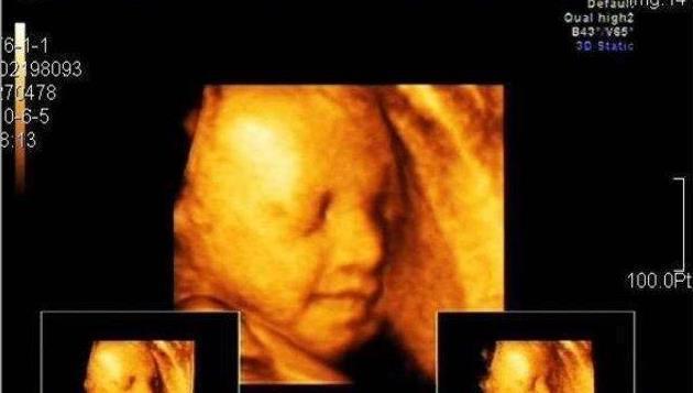 元气满满|四维彩超有点“贵”，准妈妈这样做，检查一次通过，物超所值