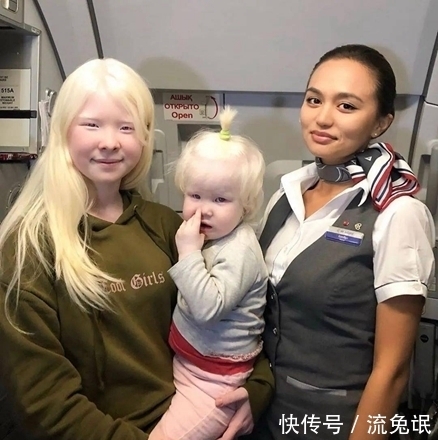 生而白首|一对罕见的“月亮姐妹”,被人嘲讽14年,拍完一组照片后惊艳众人