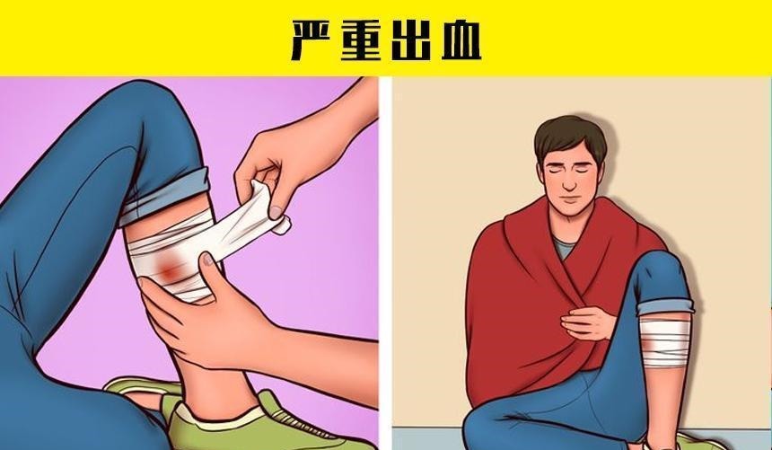 在紧急情况下，或许可以拯救生命的7个小技巧