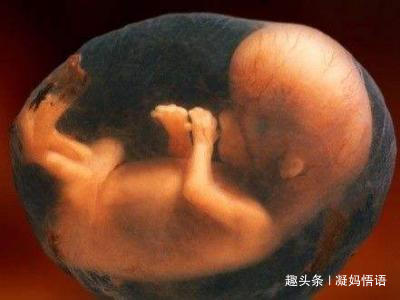 踢肚子|孕妈感觉胎儿踢肚子一般有3种情况,第三个说明宝宝在“求救”