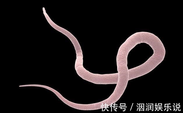 宝塔糖|为什么以前农村小孩每年要吃打虫药,现在却少有人吃了