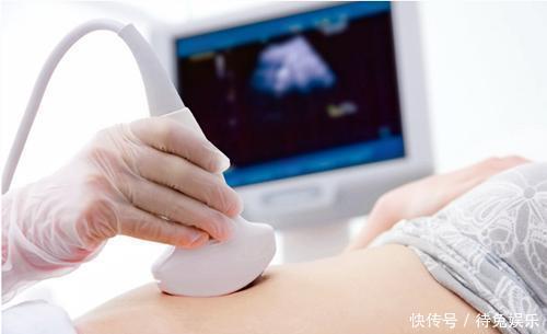 头次孕检查出怀有双胞胎,全家高兴,孩子出生后却把一家人吓懵了