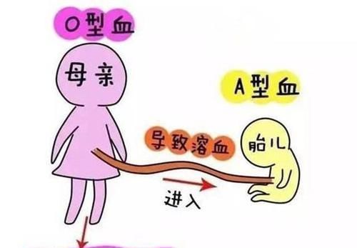 妈妈|这两种血型的妈妈，首次怀孕最好别流掉，第一个宝宝对你很重要