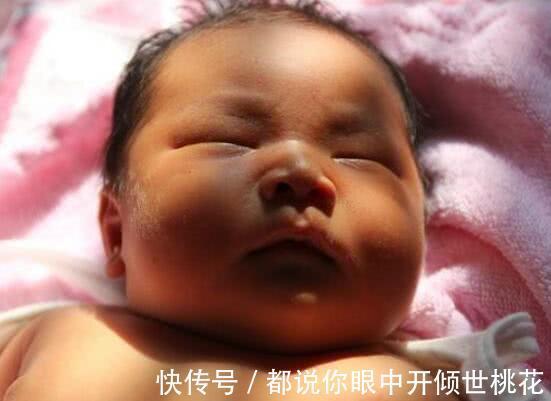 酸性|孩子出生后出现黄疸,多半是孕期时的坏习惯导致,要留心!