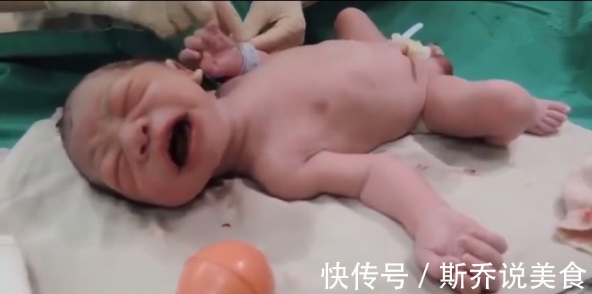子宫|宝宝出生后被医生抱走的神秘十分钟都经历了什么看完真的萌到了