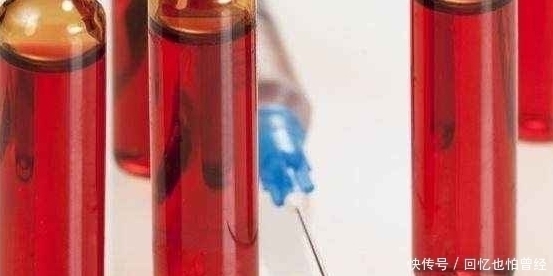 rh血型|这两种血型的女人，第一胎尽量不要流掉，第一个孩子对你很重要