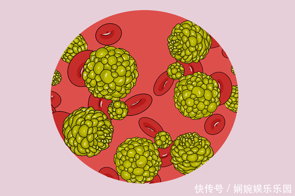 癌细胞也会主动消失医生提醒在4种情况下,确实会有惊喜