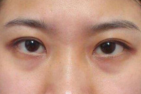 内分泌|子宫“堆满垃圾”的女人，脸上多有这些“痕迹”，外人一眼能看出