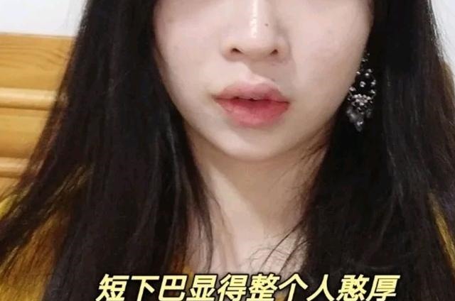 假体 假体下巴这个手术对下庭改善大吗!