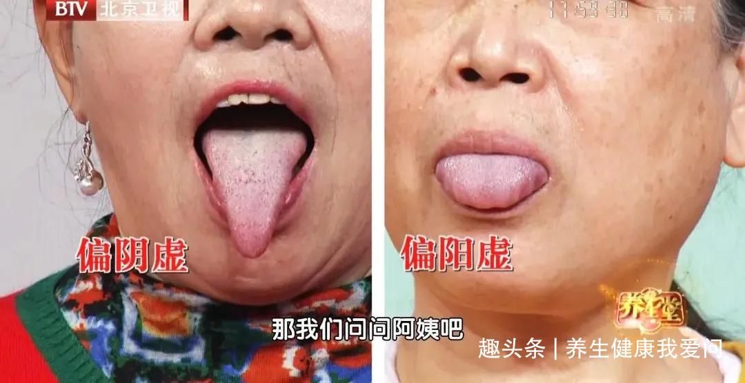 名医|九旬名医常用的2个食疗方,滋肾阴、养肾气!